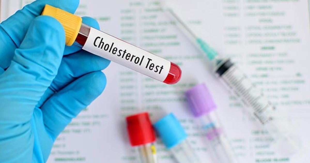 lieknamatrix-sk-cholesterol-featured